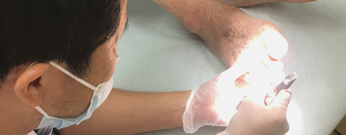 皮膚科の先生が施術している様子